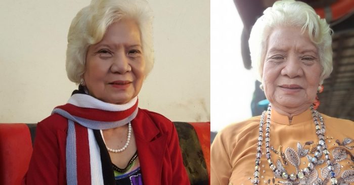 Nữ hộ sinh quốc gia 83 tuổi: chống gậy 13 năm, đã bỏ gậy sau 3 tháng tập Pháp Luân Công