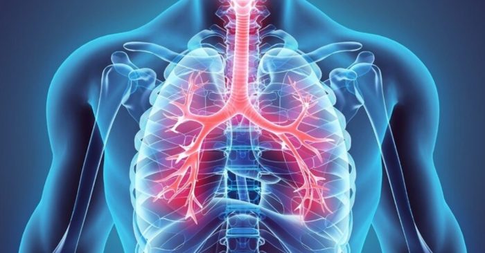 5 dấu hiệu cho thấy phổi của bạn đang mắc bệnh