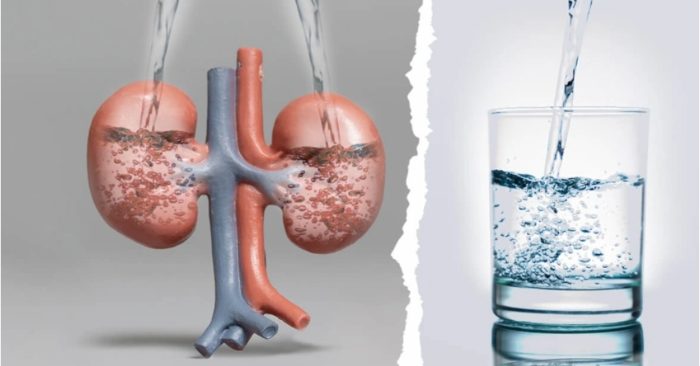 4 kiểu uống nước sai cách gây hại cho thận